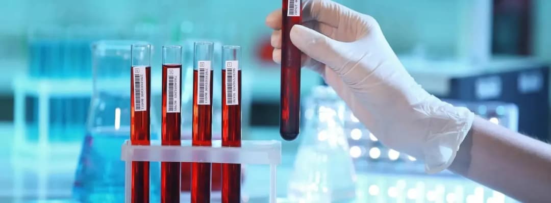 Jakie badanie krwi w kierunku Hashimoto pomoże w diagnozie?