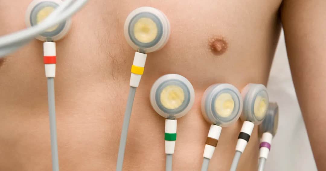 Jak długo trwa badanie wysiłkowe serca? Poznaj szczegóły i fakty